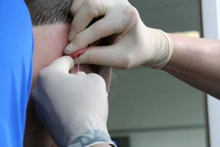 Blut abnehmen am Ohr - Lactatmessung